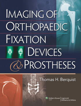 Berquist |  Imaging of Orthopaedic Fixation Devices and Prostheses | Buch |  Sack Fachmedien