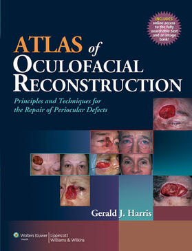 Harris | Atlas of Oculofacial Reconstruction | Buch | 978-0-7817-9651-4 | sack.de