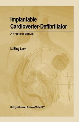 Liem |  Implantable Cardioverter-Defibrillator | Buch |  Sack Fachmedien