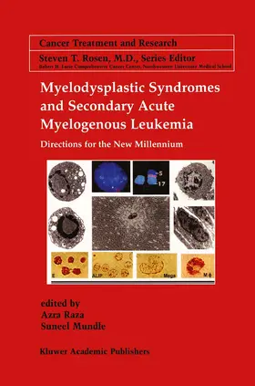 Mundle / Raza |  Myelodysplastic Syndromes & Secondary Acute Myelogenous Leukemia | Buch |  Sack Fachmedien