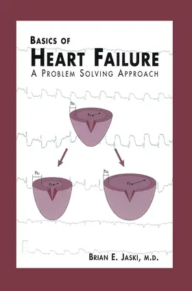 Jaski |  Basics of Heart Failure | Buch |  Sack Fachmedien