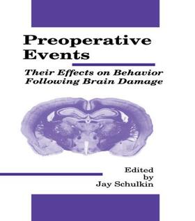 Schulkin |  Preoperative Events | Buch |  Sack Fachmedien