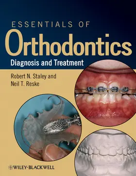 Staley / Reske |  Essentials of Orthodontics | Buch |  Sack Fachmedien