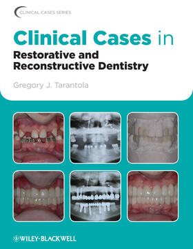 Tarantola |  Clinical Cases in Restorative and Reconstructive Dentistry | Buch |  Sack Fachmedien