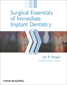 Beagle |  Surgical Essentials of Immediate Implant Dentistry | Buch |  Sack Fachmedien