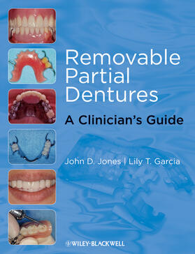 Jones / García |  Removable Partial Dentures | Buch |  Sack Fachmedien