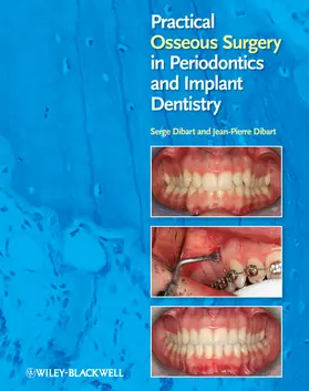 Dibart |  Practical Osseous Surgery in Periodontics and Implant Dentistry | Buch |  Sack Fachmedien