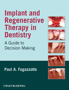 Fugazzotto |  Implant and Regenerative Thera | Buch |  Sack Fachmedien
