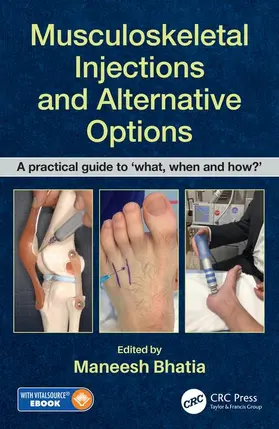 Bhatia |  Musculoskeletal Injections and Alternative Options | Buch |  Sack Fachmedien