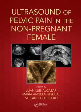 Alcázar / Pascual / Guerriero |  Ultrasound of Pelvic Pain in the Non-Pregnant Patient | Buch |  Sack Fachmedien