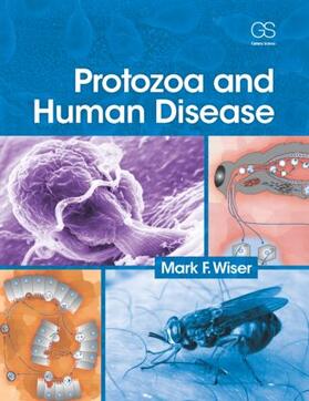 Wiser |  Protozoa and Human Disease | Buch |  Sack Fachmedien