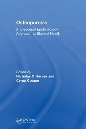 Harvey / Cooper |  Osteoporosis | Buch |  Sack Fachmedien