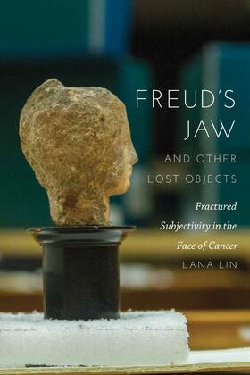 Lin |  Freud's Jaw and Other Lost Objects | eBook | Sack Fachmedien