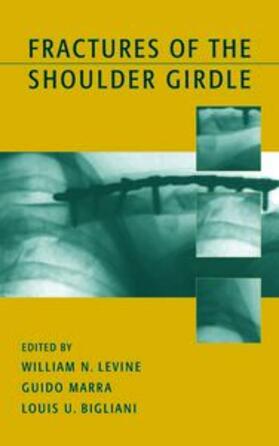 Levine / Marra |  Fractures of the Shoulder Girdle | Buch |  Sack Fachmedien
