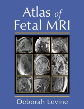 Levine |  Atlas of Fetal MRI | Buch |  Sack Fachmedien