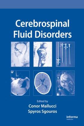 Mallucci / Sgouros |  Cerebrospinal Fluid Disorders | Buch |  Sack Fachmedien