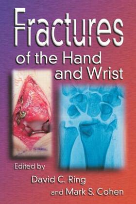 Ring / Cohen |  Fractures of the Hand and Wrist | Buch |  Sack Fachmedien