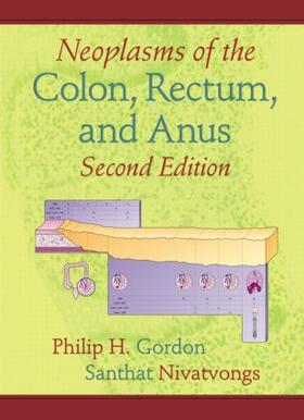 Gordon / Nivatvongs |  Neoplasms of the Colon, Rectum, and Anus | Buch |  Sack Fachmedien