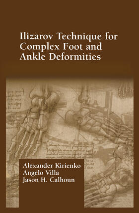 Kirienko / Villa / Calhoun |  Ilizarov Technique for Complex Foot and Ankle Deformities | Buch |  Sack Fachmedien