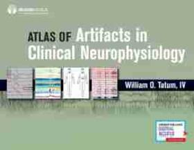 Tatum |  Atlas of Artifacts in Clinical Neurophysiology | Buch |  Sack Fachmedien