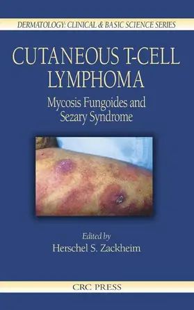 Zackheim |  Cutaneous T-Cell Lymphoma | Buch |  Sack Fachmedien