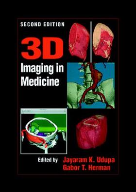 Udupa / Herman |  3D Imaging in Medicine, Second Edition | Buch |  Sack Fachmedien