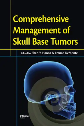 Hanna / DeMonte |  Comprehensive Management of Skull Base Tumors | Buch |  Sack Fachmedien