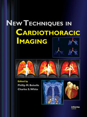 Boiselle / White |  New Techniques in Cardiothoracic Imaging | Buch |  Sack Fachmedien