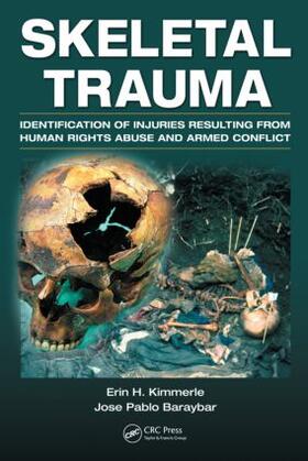 Kimmerle / Baraybar |  Skeletal Trauma | Buch |  Sack Fachmedien