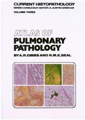 Seal / Gibbs |  Atlas of Pulmonary Pathology | Buch |  Sack Fachmedien