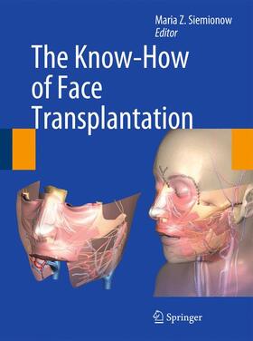Siemionow |  The Know-How of Face Transplantation | Buch |  Sack Fachmedien