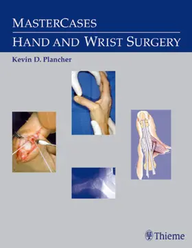 Plancher |  MasterCases in Hand and Wrist Surgery | Buch |  Sack Fachmedien