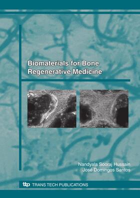 Sooraj Hussain / Santos |  Biomaterials for Bone, Regenerative Medicine | Buch |  Sack Fachmedien