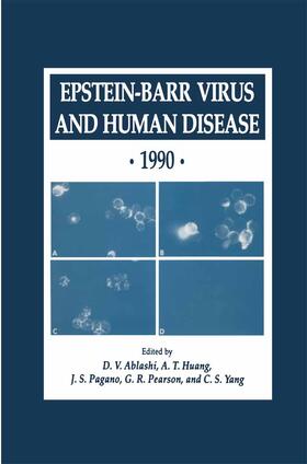 Ablashi / Huang / Yang |  Epstein-Barr Virus and Human Disease · 1990 | Buch |  Sack Fachmedien