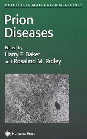 Ridley / Baker |  Prion Diseases | Buch |  Sack Fachmedien