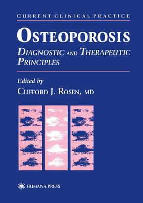 Rosen |  Osteoporosis | Buch |  Sack Fachmedien