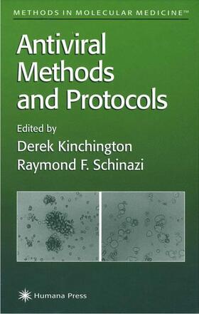 Schinazi / Kinchington |  Antiviral Methods and Protocols | Buch |  Sack Fachmedien