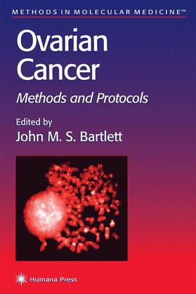 Bartlett |  Ovarian Cancer | Buch |  Sack Fachmedien