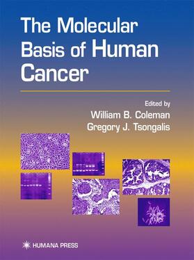 Coleman / Tsongalis |  The Molecular Basis of Human Cancer | Buch |  Sack Fachmedien