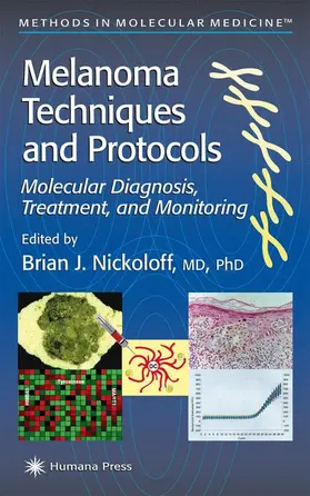 Nickoloff |  Melanoma Techniques and Protocols | Buch |  Sack Fachmedien