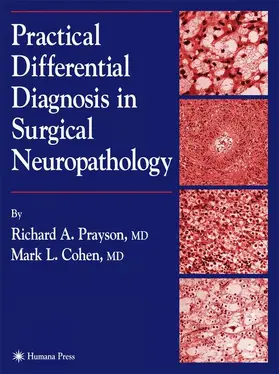 Cohen / Prayson |  Practical Differential Diagnosis in Surgical Neuropathology | Buch |  Sack Fachmedien