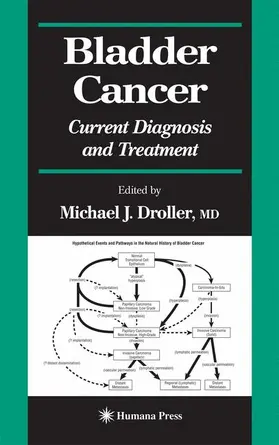 Droller |  Bladder Cancer | Buch |  Sack Fachmedien