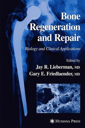 Friedlaender / Lieberman |  Bone Regeneration and Repair | Buch |  Sack Fachmedien