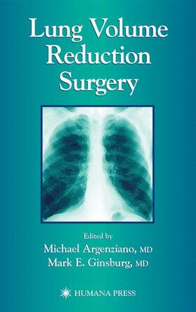 Argenziano / Ginsburg |  Lung Volume Reduction Surgery | Buch |  Sack Fachmedien