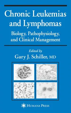 Schiller |  Chronic Leukemias and Lymphomas | Buch |  Sack Fachmedien