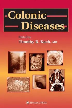 Koch |  Colonic Diseases | Buch |  Sack Fachmedien