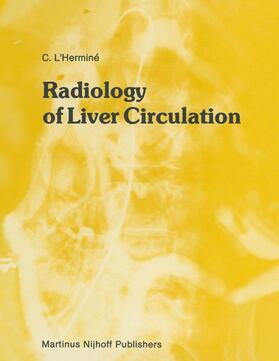 L'Herminé |  Radiology of Liver Circulation | Buch |  Sack Fachmedien
