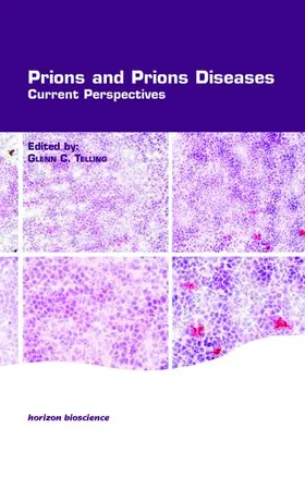 Telling |  Prions and Prion Diseases | Buch |  Sack Fachmedien