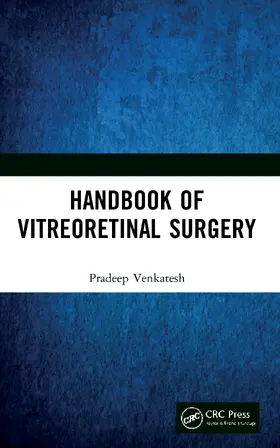 Venkatesh |  Handbook of Vitreoretinal Surgery | Buch |  Sack Fachmedien