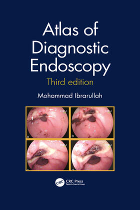 Ibrarullah |  Atlas of Diagnostic Endoscopy, 3E | Buch |  Sack Fachmedien